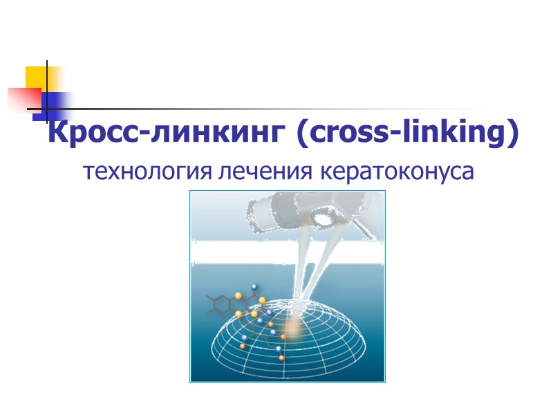 Кросс-линкинг (cross-linking)     технология лечения кератоконуса